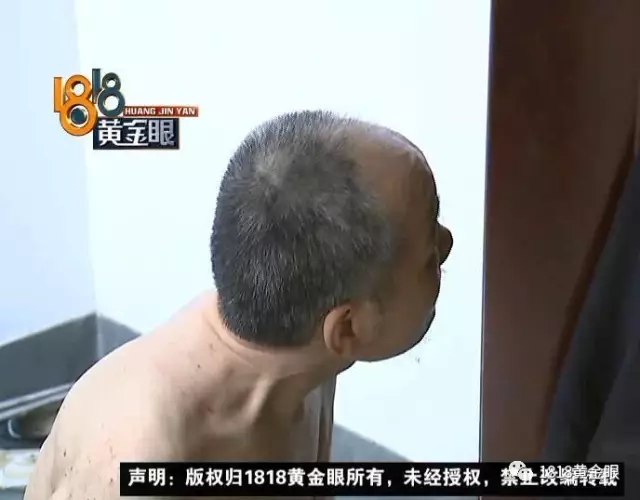 父亲住楼道外女儿却希望不相往来 网友评论戳泪点