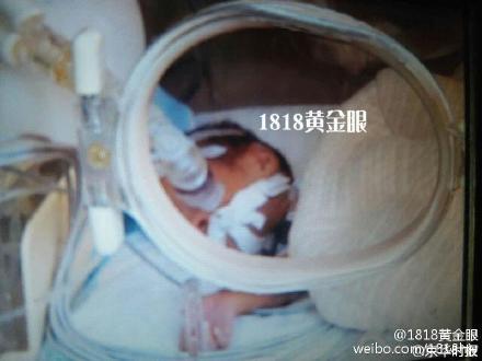 婴儿被开死亡证明送殡仪馆冷藏 火化前传出哭声