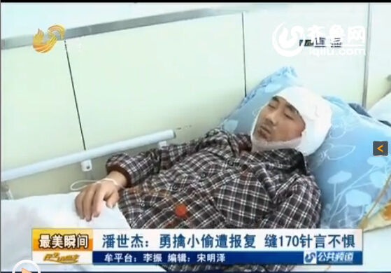 山东男子勇斗歹徒耳朵被捅穿 全身缝170多针