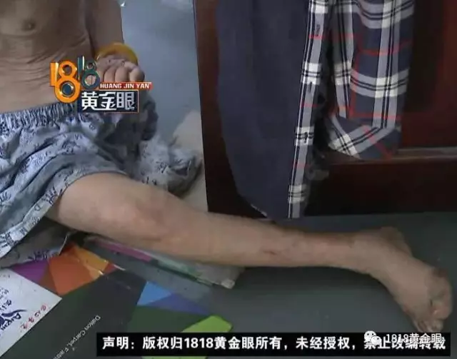 父亲住楼道外女儿却希望不相往来 网友评论戳泪点