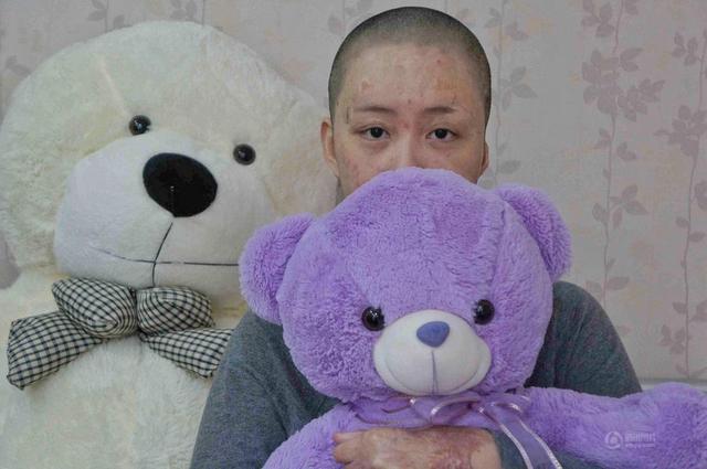 合肥少女被毁容案宣判 受害少女周岩获赔172万