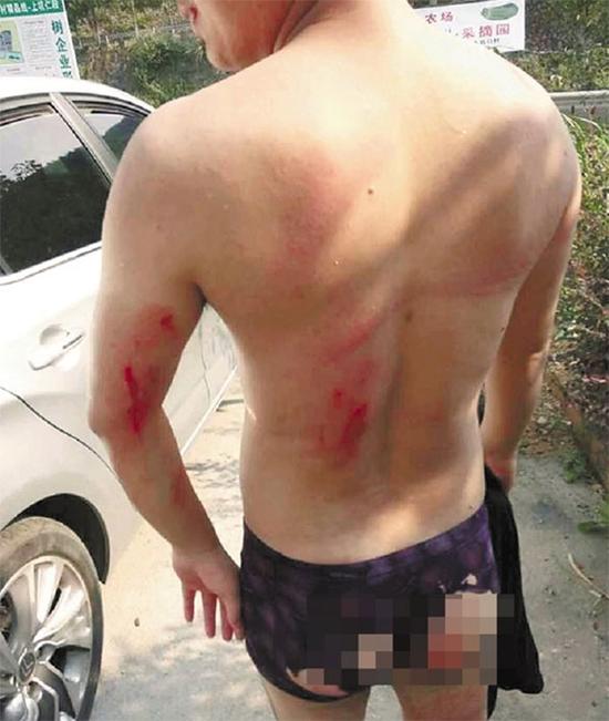 泳裤被划破，身上被擦伤。