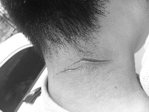 民警夺刀被划伤