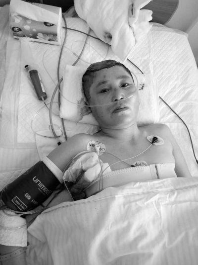 被咬伤的双玉还在等待第二次手术