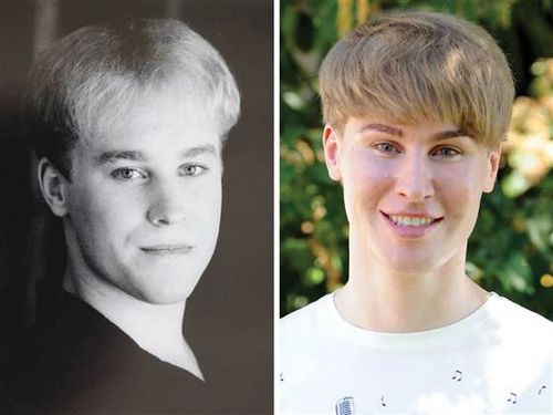 男子花近10万美元整容为“长”得似偶像（图）