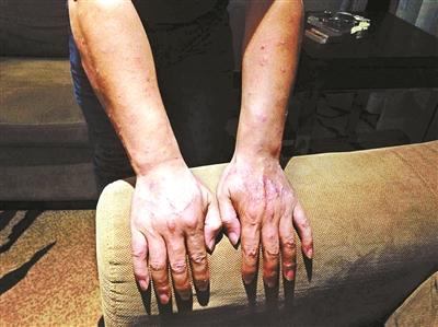 江苏一养猪场地下被指埋毒万吨 环保部介入调查