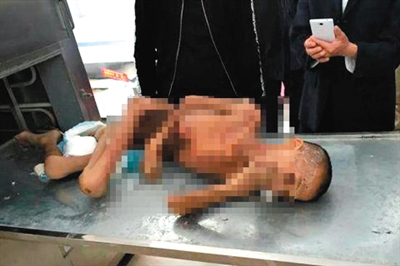 乐乐(化名)的尸体瘦得只剩皮包骨。图片来自网络