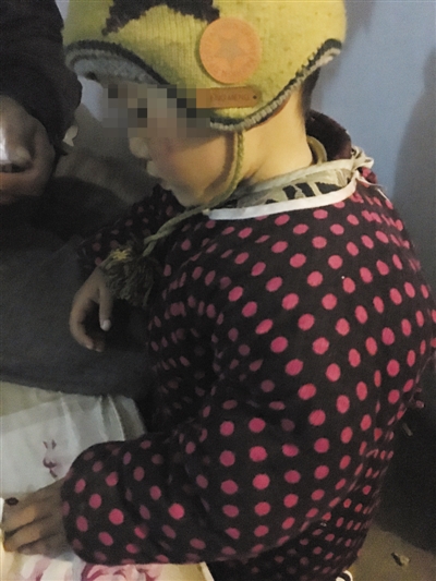 住院前，政政在出租屋内玩。