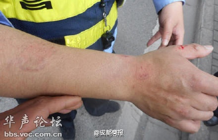 按此在新窗口浏览图片