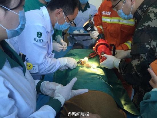 消防员和医生合力取螺帽