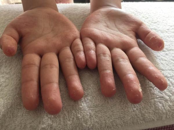 甘肃一中学消防演练用军用发烟罐 百余学生中毒